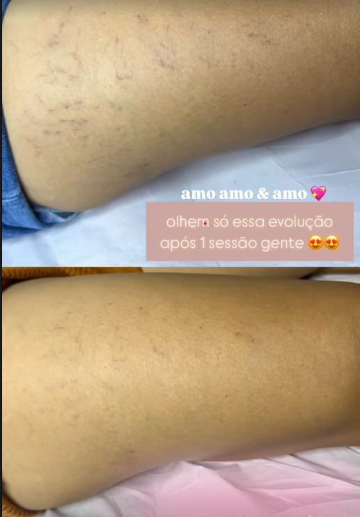 Depoimento de cliente 4